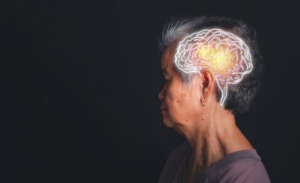 Image: Adobe a woman with short grey hair looks to the left on a black background, a white superimposed drawing of a brain is on her head